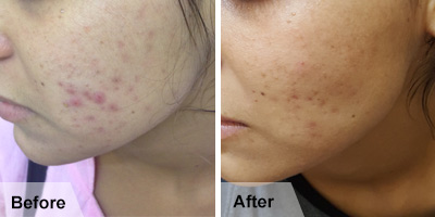 Skin Problems